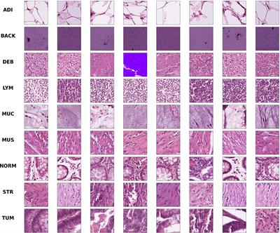 An improved multi-scale gradient generative adversarial network for enhancing classification of colorectal cancer histological images